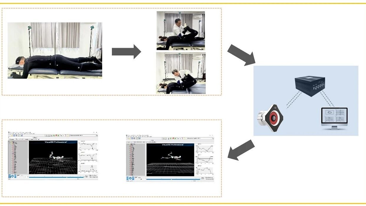 Zhejiang Chinese Medical University: In Vivo Kinematic Quantification of LPM Supports Individualized Tuina Treatment for Lumbar Disc Herniation